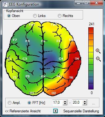 Brainmap mit Verteilung von Beta 17-20 Hz