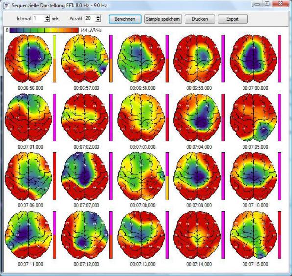 Sequenzielles Brainmap in 1-Sekunden-Schritten