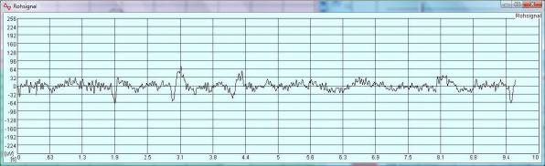EEG Rohdaten - digitale Messung von Gehirnströmen 