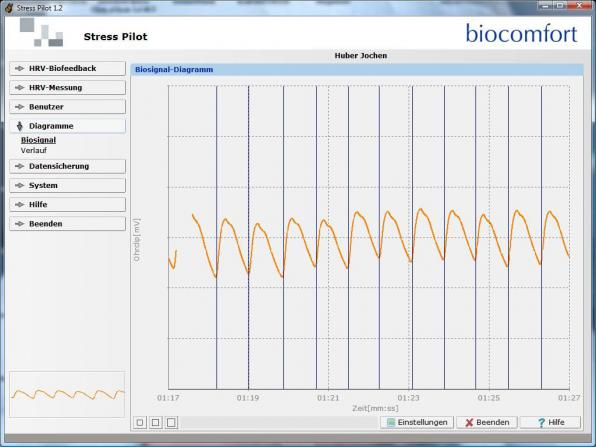 Herzratenvariabilität (HRV) - Biosignalmessung